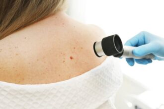 Skin Cancer Prevention